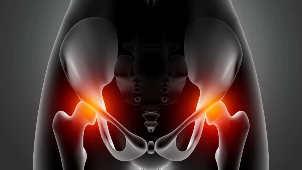 hip procedures - hip replaceemnt treatment