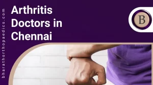 Arthritis Doctors in Chennai