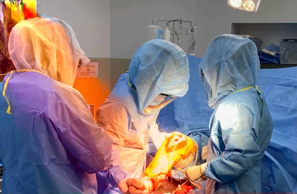 Knee Replacement Surgeons in Chennai