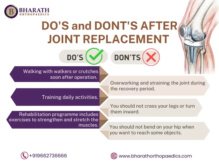 Joint Replacement Surgery in Chennai | Bharath Orthopaedics