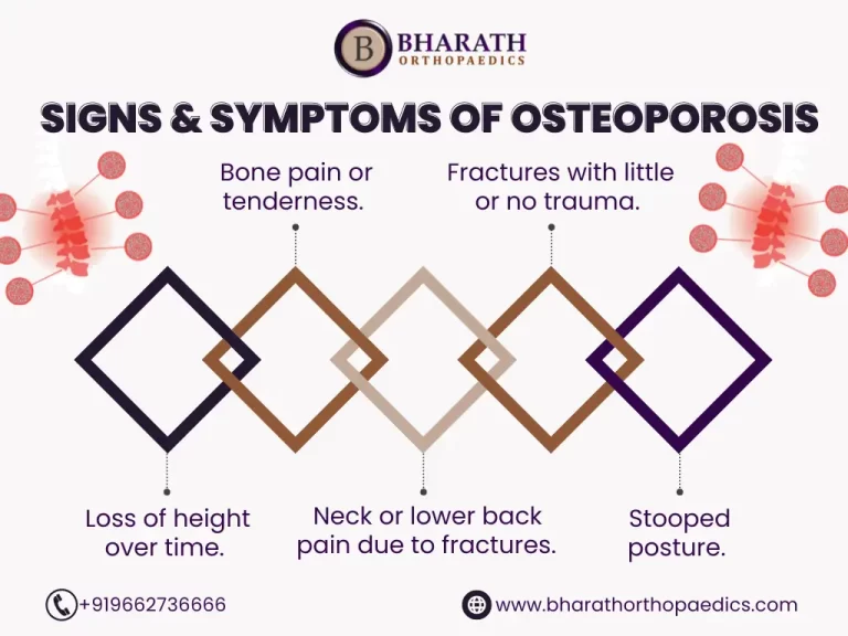 Best Osteoporosis Doctors in India | Bharath Orthopaedics