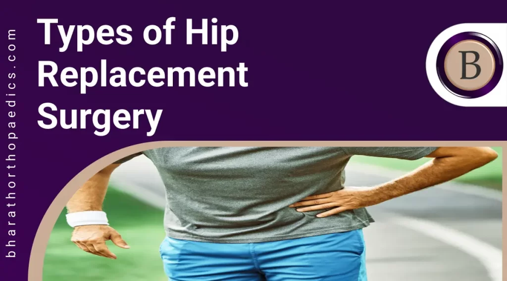 Types of Hip Replacement Surgery | Bharath Orthopaedics