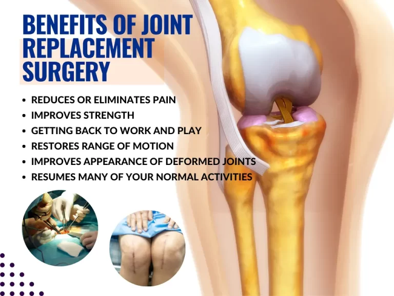 joint replacement surgery in chennai | Bharath Orthopaedics