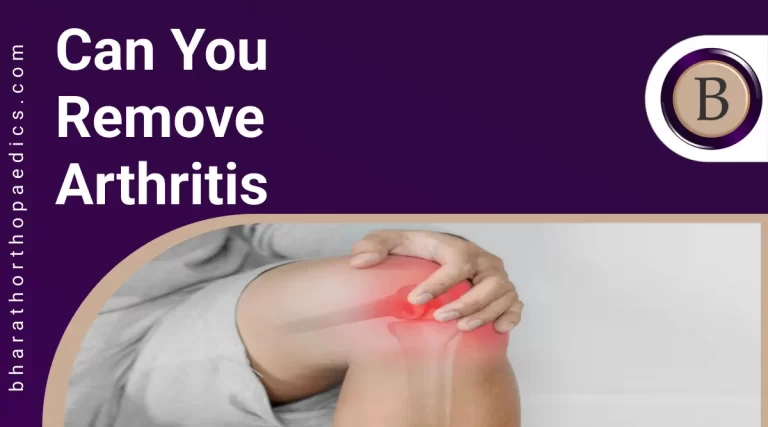 Can You Remove Arthritis | Bharath Orthopaedics