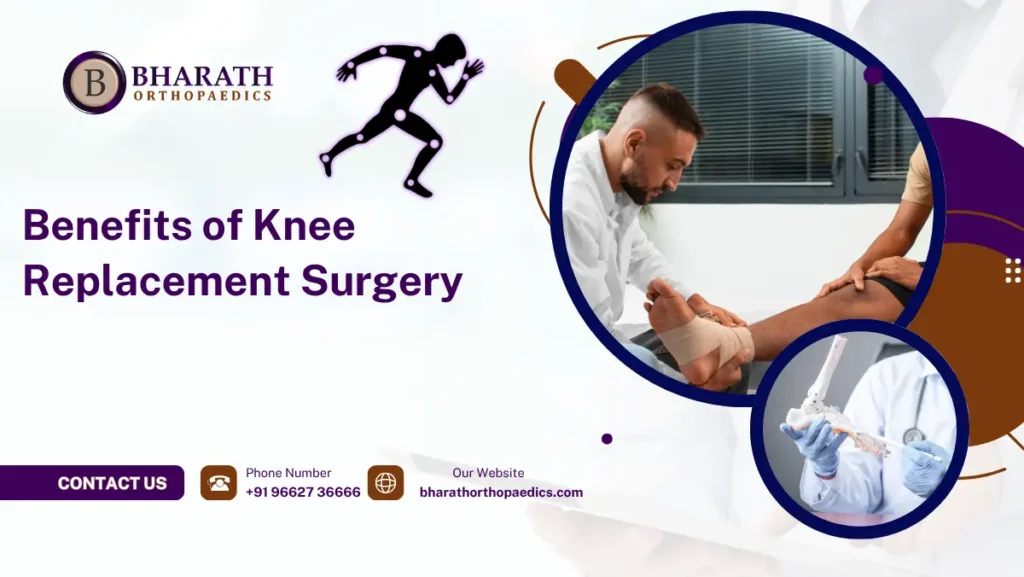 Benefits of Knee Replacement Surgery