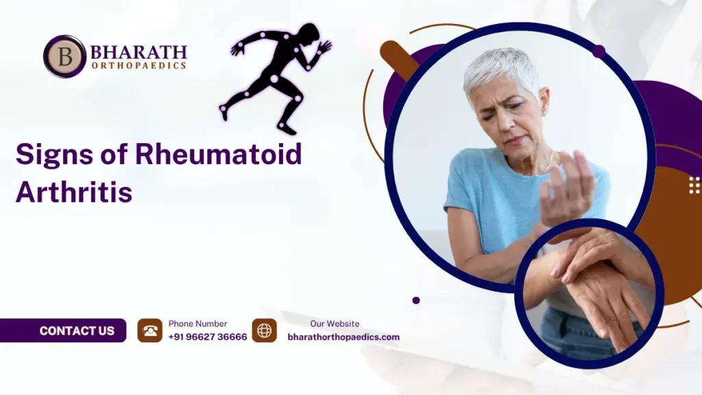 Signs of Rheumatoid Arthritis