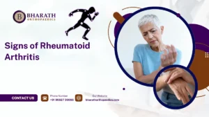 Signs of Rheumatoid Arthritis