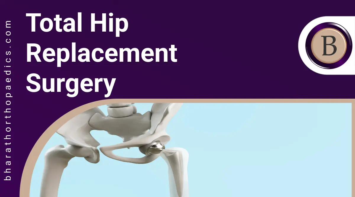 Total Hip Replacement Surgery | 100% Best Treatment