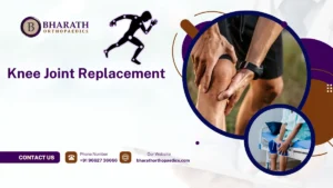 Knee Joint Replacement