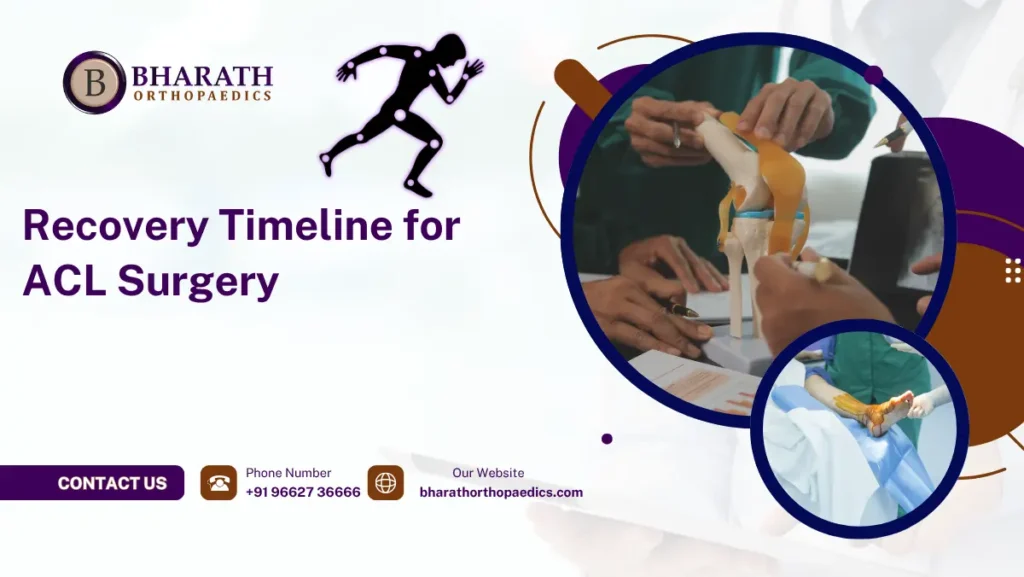 Recovery Timeline for ACL Surgery