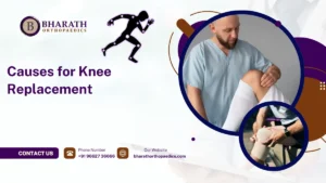 Causes for Knee Replacement