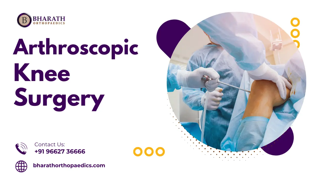 Arthroscopic Knee Surgery