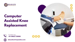 Computer Assisted Knee Replacement