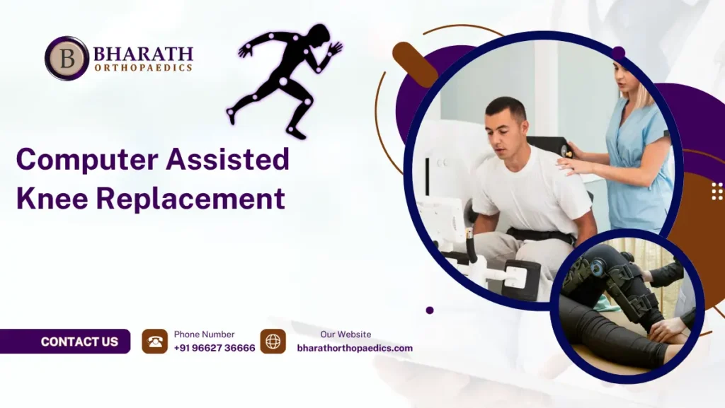 Computer Assisted Knee Replacement