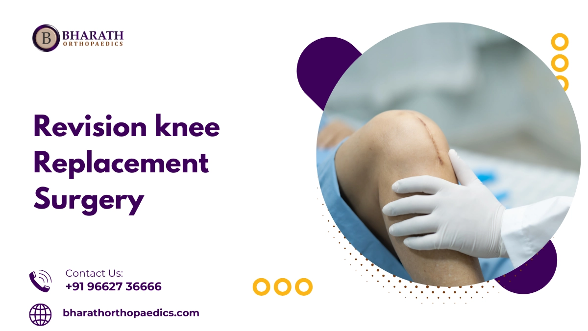 revision knee replacement surgery