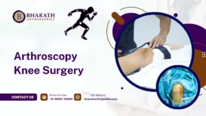 Arthroscopy Knee Surgery