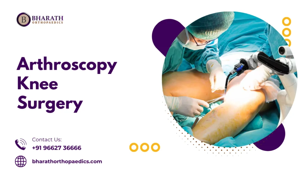 Arthroscopy Knee Surgery