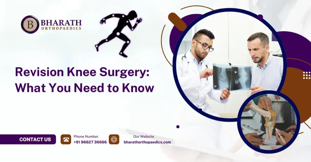 Revision Knee Surgery_ What You Need to Know
