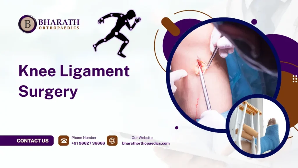 Knee Ligament Surgery