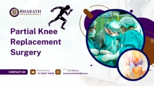 Partial Knee Replacement Surgery