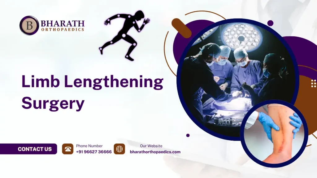 Limb Lengthening Surgery in Chennai