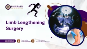 Limb Lengthening Surgery in Chennai