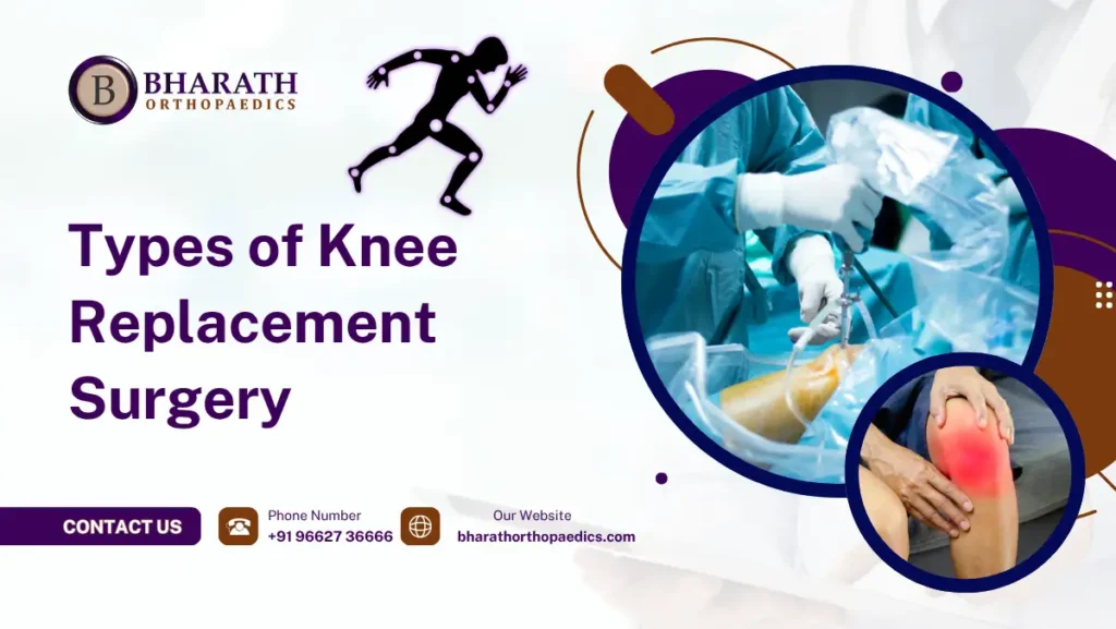 Types of Knee Replacement Surgery
