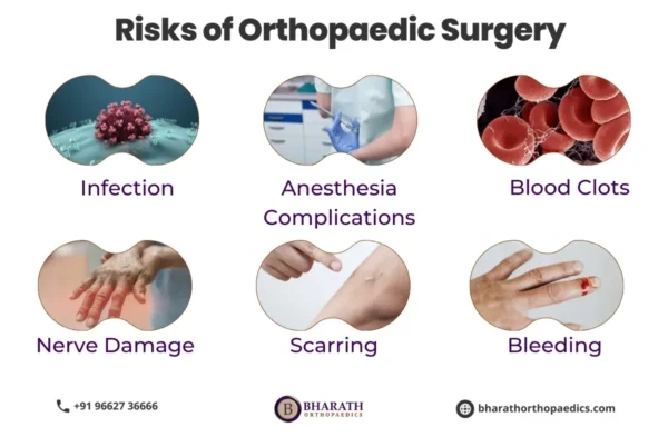 Best Orthopaedic Surgeons in India