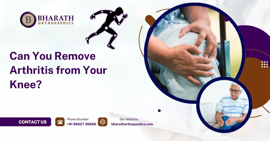 Can You Remove Arthritis from Your Knee