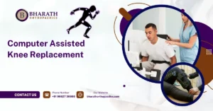 Computer Assisted Knee Replacement