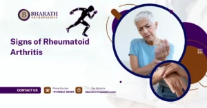 Signs of Rheumatoid Arthritis