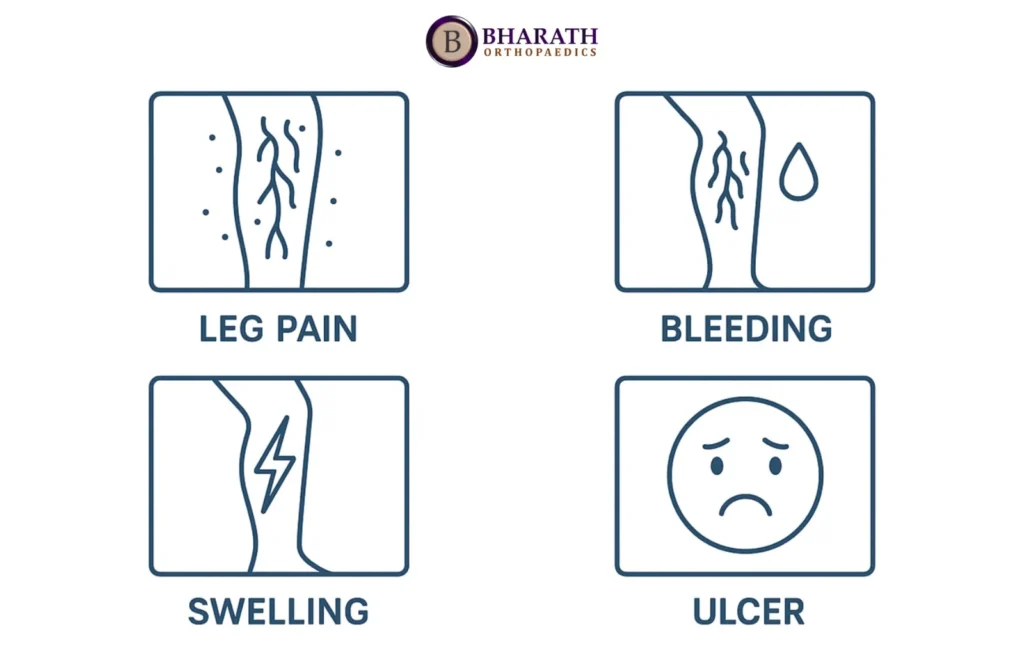 When to worry about varicose veins 