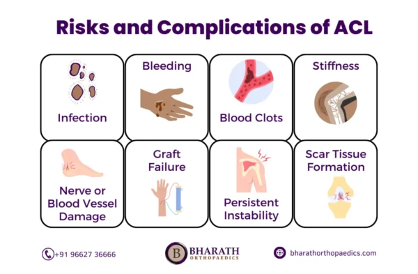 ACL Surgery in Chennai