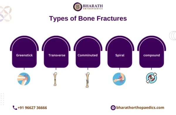 Stress Fracture of the Shin