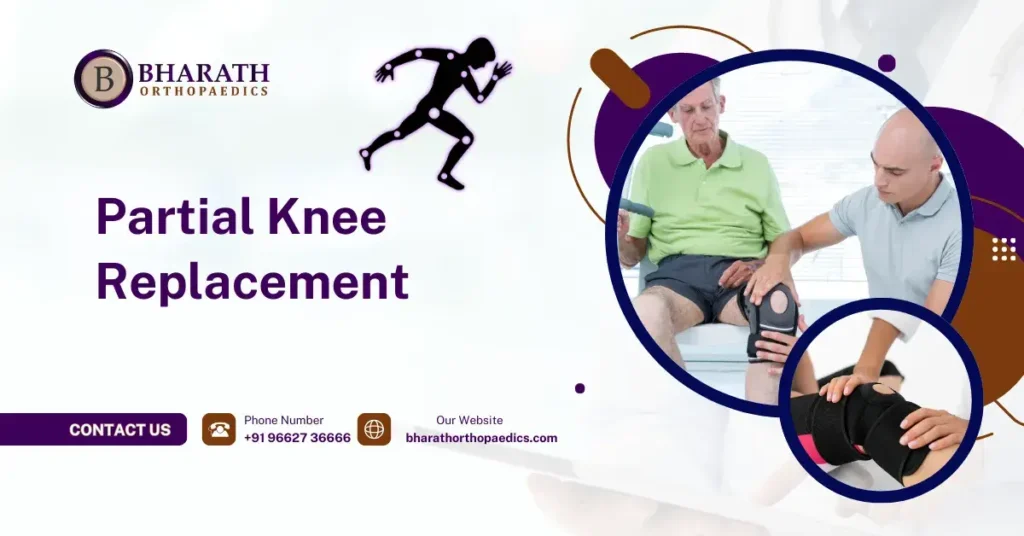 Partial Knee Replacement