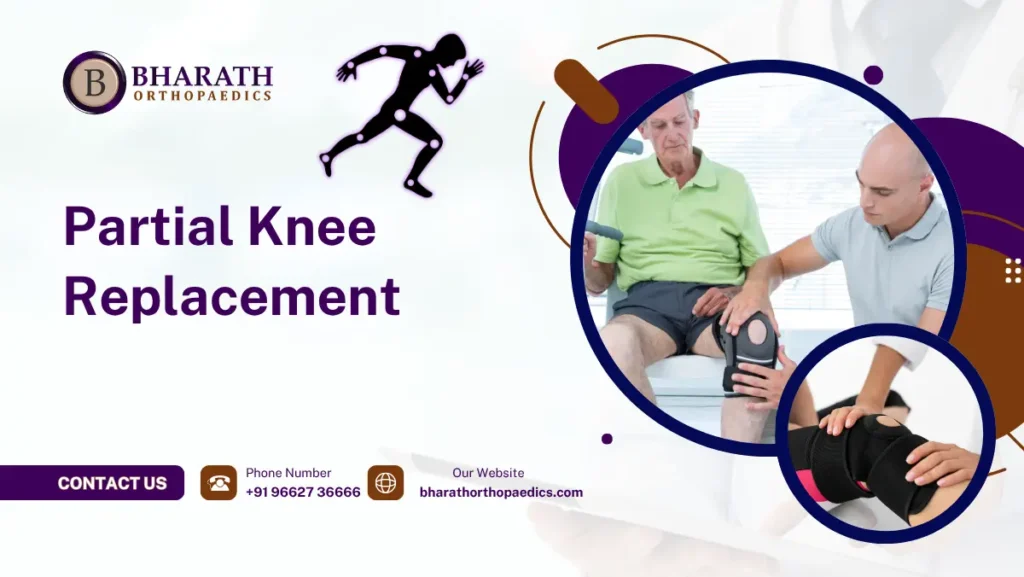 Partial Knee Replacement